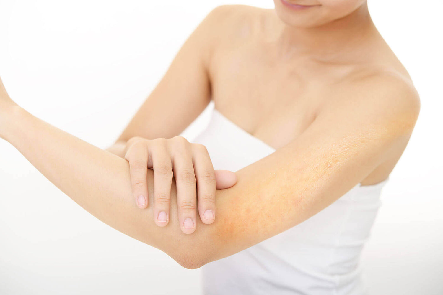 Keratosis Pilaris