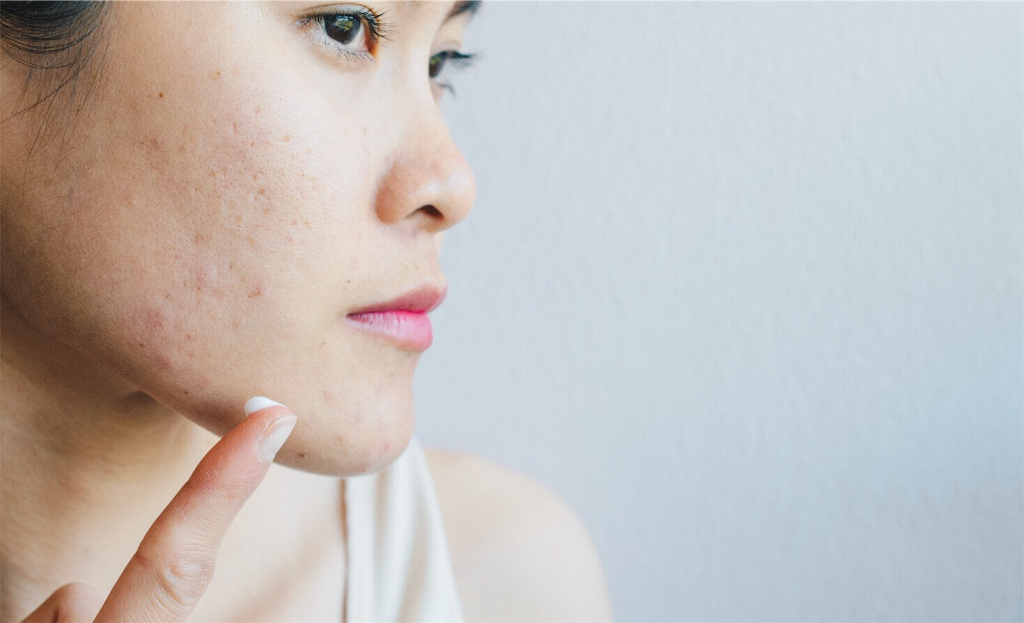 Skin Care for blackheads and large pores